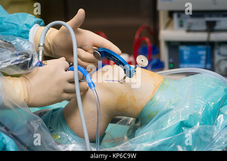 LIGAMENT SURGERY Stock Photo