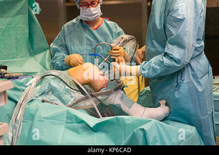 LIGAMENT SURGERY Stock Photo