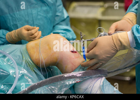 LIGAMENT SURGERY Stock Photo