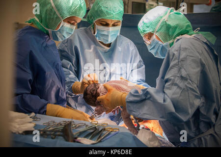 CESAREAN BIRTH Stock Photo