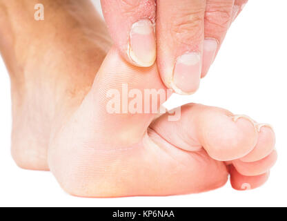 Male person pulling big toe backwards isolated towards white Stock Photo