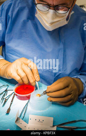 Implantation under general anesthesia of a retinal prosthesis Argus® II (Second Sight), Ophthalmology department of Bordeaux Hospital, France. Stock Photo