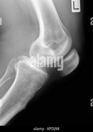 Human knee Stock Photo
