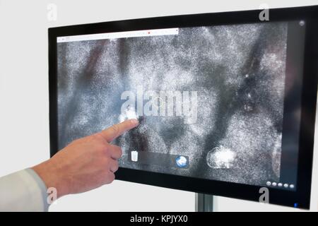 Doctor pointing at computer monitor in skin clinic. On the screen is visible a scan of the stratum corneum of the patient's skin. Stock Photo