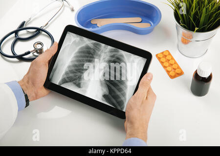 doctor analyzing patient lung x-ray results on digital tablet Stock Photo