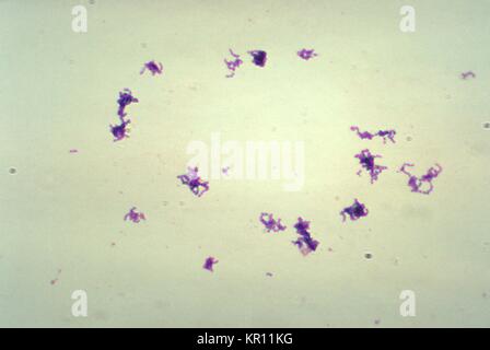 This micrograph depicts a number of Peptostreptococcus sp, 1974. bacteria that had been grown in Schaedler?s broth, and processed using Gram-stain technique. Peptostreptococcus spp. are anaerobic, non-spore forming, Gram-positive cocci, which are part of the normal flora of the skin and mucosal surfaces of humans. Image courtesy CDC/Don Stalons. Stock Photo