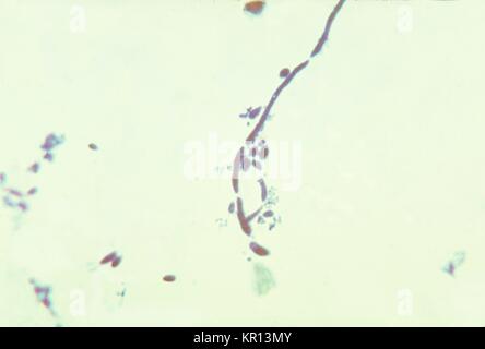 This is a photomicrograph of the fungus Candida albicans in a sputum sample, 1963. Candida albicans lives in numerous parts of the body as normal flora. However, when an imbalance occurs, such as when hormonal balances change, C. albicans can multiply, resulting in a mucosal or skin infection called Candidiasis . Image courtesy CDC/Sherry Brinkman. Stock Photo