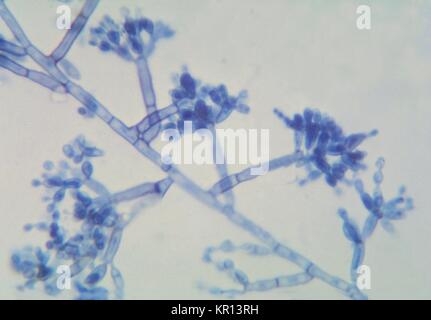 This is a photomicrograph of the fungus Hortaea werneckii, the