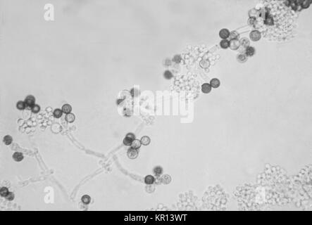 This is an image of chlamydospores, the reproductive, thick-walled structures of the fungus Candida albicans, 1963. Chlamydospores are a specialized type of spore that are larger than the standard spores produced by the particular fungus and have very thick walls. Chlamydospores are usually dark in pigment. Image courtesy CDC/Dr. Gordon Roberstad. Stock Photo