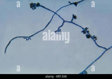 Tinea nigra hi-res stock photography and images - Alamy