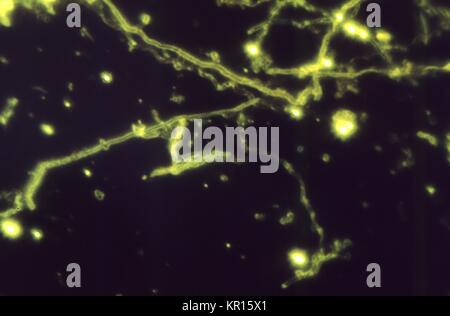 A photomicrograph of Actinomyces naeslundii using an Immunofluorescent Antibody staining technique, Magnified 1187X, 1969. When growing as filaments, these Gram-positive rods are often said to portray a 'Dust Bunny' appearance photomicrographically. <actinomyces> spp. are usually seen only in immunosuppressed patients, such as those with AIDS.</actinomyces>. Image courtesy CDC/Dr. Lucille Georg. Stock Photo