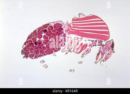 A photomicrograph revealing the histology of Onchocerca volvulus developing in a Black Fly, Simulium ochraceum, 1978. O. volvulus, the filarial parasite responsible for causing Onchocerciasis, River Blindness, is transmitted to its human host through the bite of Simulium spp. flies such as the Black Fly. Image courtesy CDC/Dr. R.C. Collins. Stock Photo