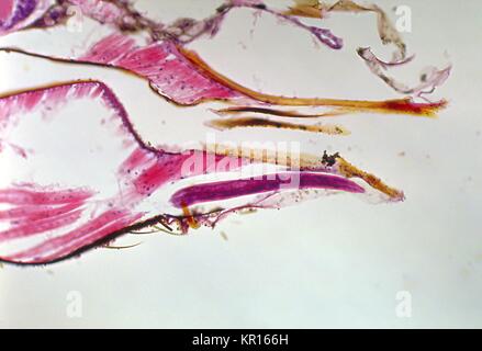 A photomicrograph revealing the histology of Onchocerca volvulus developing in a black fly, Simulium ochraceum, 1978. O. volvulus, the filarial parasite responsible for causing Onchocerciasis, River Blindness, is transmitted to its human host through the bite of Simulium spp. flies such as the Black Fly. Image courtesy CDC/Dr. R.C. Collins. Stock Photo