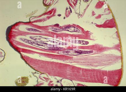 A photomicrograph revealing the histology of Onchocerca volvulus developing in a Black Fly, Simulium ochraceum, 1978. O. volvulus, the filarial parasite responsible for causing Onchocerciasis, River Blindness, is transmitted to its human host through the bite of Simulium spp. flies such as the Black Fly. Image courtesy CDC/Dr. R.C. Collins. Stock Photo