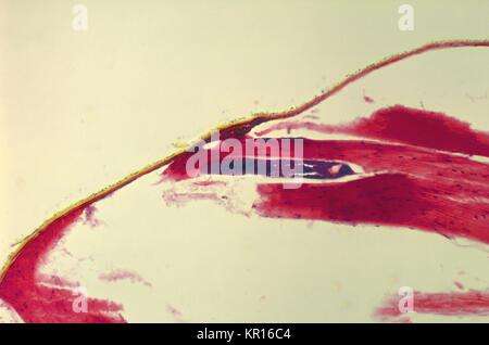 A photomicrograph revealing the histology of Onchocerca volvulus developing in a Black Fly, Simulium ochraceum, 1978. O. volvulus, the filarial parasite responsible for causing Onchocerciasis, River Blindness, is transmitted to its human host through the bite of Simulium spp. flies such as the Black Fly. Image courtesy CDC/Dr. R.C. Collins. Stock Photo