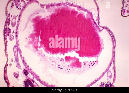 A photomicrograph revealing the histology of Onchocerca volvulus developing in a Black Fly, Simulium ochraceum, 1978. O. volvulus, the filarial parasite responsible for causing Onchocerciasis, River Blindness, is transmitted to its human host through the bite of Simulium spp. flies such as the Black Fly. Image courtesy CDC/Dr. R.C. Collins. Stock Photo