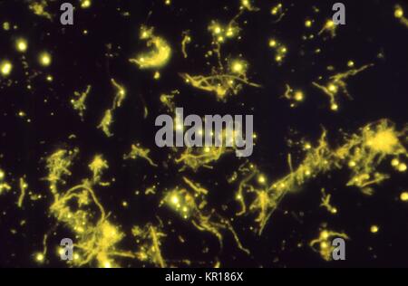 A photomicrograph of Actinomyces naeslundii using Direct FA staining technique, 1969. When growing as filaments, these Gram-positive rods are often said to portray a 'Dust Bunny' appearance photomicrographically. <actinomyces> spp. are usually seen only in immunosuppressed patients, such as those with AIDS.</actinomyces>. Image courtesy CDC/Dr. Lucille Georg. Stock Photo