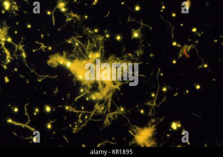 Magnified 500X, this photomicrograph reveals the presence of Actinomyces naeslundii using Direct FA staining technique, 1969. When growing as filaments, these Gram-positive rods are often said to portray a 'Dust Bunny' appearance photomicrographically. <actinomyces> spp. are usually seen only in immunosuppressed patients, such as those with AIDS.</actinomyces>. Image courtesy CDC/Dr. Lucille K. Georg. Stock Photo