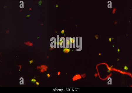 Under a magnification of 560X, this photomicrograph showing the presence of Pneumocystis jirovecii, formerly known as Pneumocystis carinii fungal organisms, 1972. This microscopic fungus, seen here using Indirect Fluorescent Antibody (IFA) microscopy, is arguably the most important cause of pneumonia in the immunocompromised host, such as an individual with AIDS. Image courtesy CDC/Lois Norman. Stock Photo