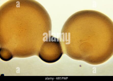 Photomicrograph of Neisseria gonorrhoeae colonies growing on GC base media with IsoVitalex after 24 hours, 1972. N. gonorrhoeae, a gram-negative diplococcus, is the causative agent for Gonorrhea. These bacteria can infect the genital tract, the mouth, and the rectum. Image courtesy CDC/W. Jerry Brown. Stock Photo