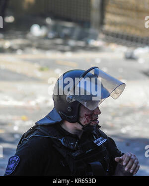 Buenos Aires, Argentina. 18th Dec, 2017. Police injured during a protest against the pension reform on December 18, 2017 in Buenos Aires, Argentina. Credit: Gabriel Sotelo/FotoArena/Alamy Live News