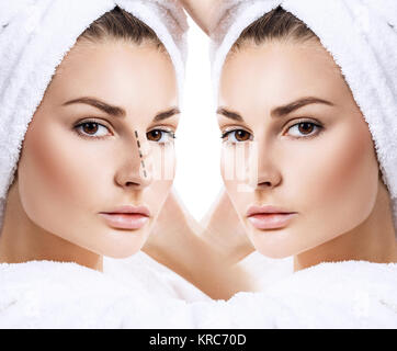 Comparison portrait of female nose before and after cosmetic surgery. Rhinoplasty concept. Stock Photo