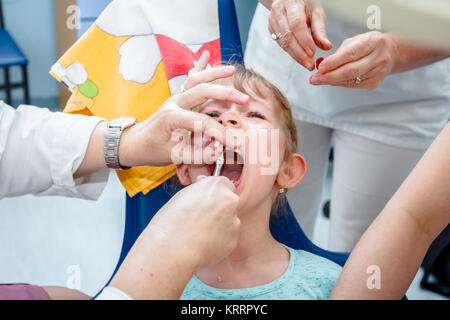 Preschooler child is at dentist office, medical forceps are extracting a milk tooth. Stock Photo
