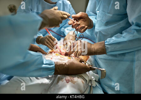 Abdominal operation process Stock Photo