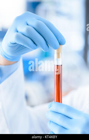 Close-up partial view of scientist in protective gloves holding test tube with reagent Stock Photo