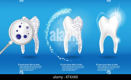 Dental health Concept Vector set. 3d realistic shiny clean and dirty tooth on blue background, clearing and Whitening tooth process. Oral Care, teeth restoration Stock Vector