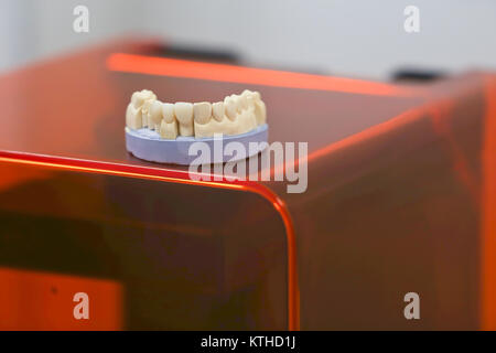 The lower jaw of a man, created on a 3d printer from a photopolymer material. Stereolithography 3D printer, technology of liquid photopolymerization u Stock Photo