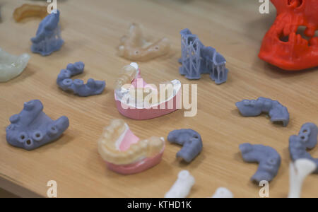 The lower jaw of a man, created on a 3d printer from a photopolymer material. Stereolithography 3D printer, technology of liquid photopolymerization u Stock Photo