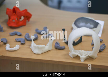 The lower jaw of a man, created on a 3d printer from a photopolymer material. Stereolithography 3D printer, technology of liquid photopolymerization u Stock Photo