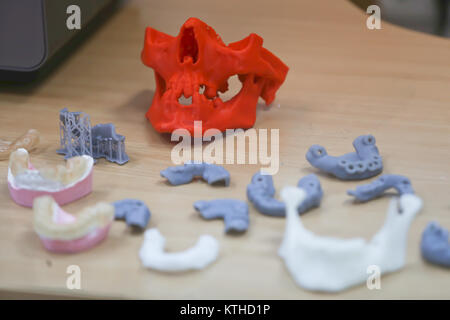 The lower jaw of a man, created on a 3d printer from a photopolymer material. Stereolithography 3D printer, technology of liquid photopolymerization u Stock Photo
