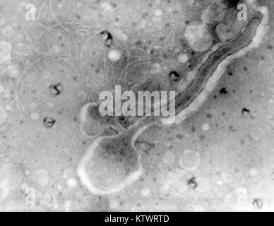 photomicrograph pallidum treponema bacterium alamy