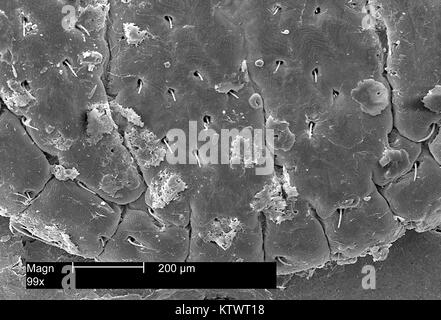 This scanning electron micrograph (SEM) depicts a dorsal view of the scutum, of an American dog tick, Dermacentor variabilis, magnified 99X. Ticks are of the class Arachnida, as are spiders and mites, 2002. D. variabilis is a known carrier of Rocky Mountain Spotted Fever caused by the bacterium Rickettsia rickettsii . Image courtesy CDC. Stock Photo