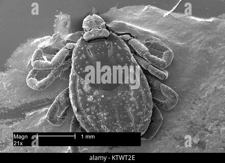 This scanning electron micrograph (SEM) presents a dorsal view of an American dog tick, Dermacentor variabilis, magnified 21X. Ticks are of the class Arachnida, as are spiders and mites, 2002. D. variabilis is a known carrier of Rocky Mountain Spotted Fever caused by the bacterium Rickettsia rickettsii . Image courtesy CDC. Stock Photo