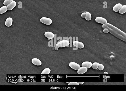 Under a magnification of 6, 408X, this scanning electron micrograph (SEM) depicted spores from the Aimes strain of Bacillus anthracis bacteria. See PHIL 10124 for a colorized version of this image. A key characteristic of the Aimes strain of B. anthracis is the smooth surface of the protein coat of these bacterial spores. These spores can live for many years which, enables the bacteria to survive in a dormant state. Image courtesy CDC/Laura Rose, 2002. Stock Photo