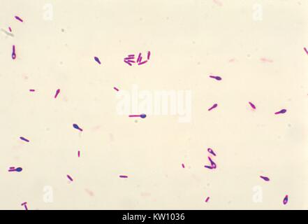 A photomicrograph of Clostridium botulinum type A viewed using a Gram ...