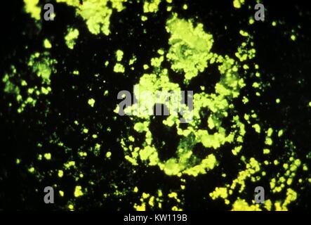 Plague bacteria (Yersinia pestis), fluorescent light micrograph. These ...