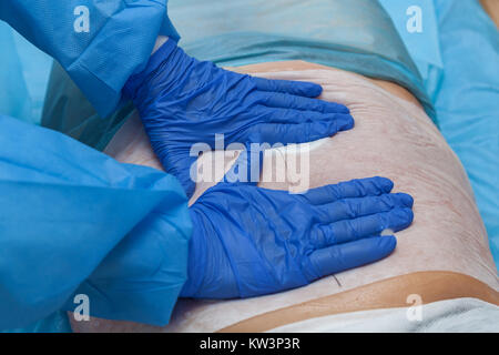 A woman undergoes the Carboxytherapy procedure on her stomach in a beauty salon. The doctor applies special paper sheets The procedure is based on oxy Stock Photo