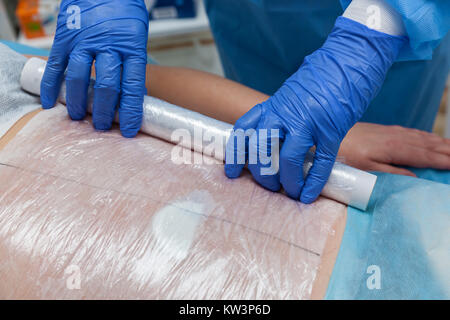 A woman undergoes the Carboxytherapy procedure on her stomach in a beauty salon. The doctor does the wrapping with a film The procedure is based on ox Stock Photo