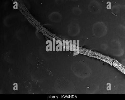 Scanning electron microscope (SEM) micrograph of a plant root, with soil debris visible, at a magnification of 100x, 2016. Stock Photo