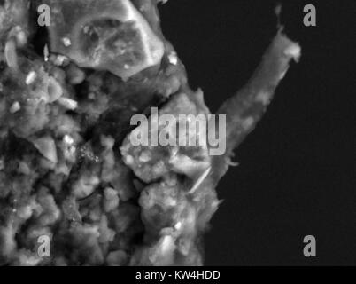 SEM - human hair Stock Photo: 4970069 - Alamy