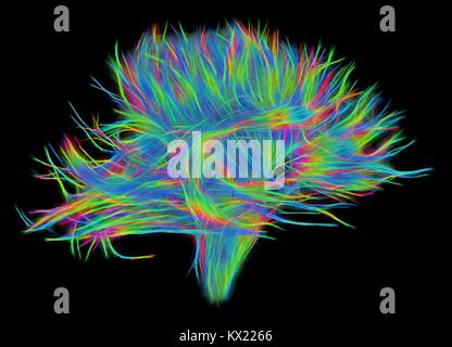 White matter fibres. Computer enhanced 3D diffusion spectral imaging (DSI) scan of the bundles of white matter nerve fibres in the brain. The fibres transmit nerve signals between brain regions and between the brain and the spinal cord. Diffusion spectrum imaging (DSI) is a variant of magnetic resonance imaging (MRI) in which a magnetic field maps the water contained in neuron fibers, thus mapping their criss-crossing patterns. A similar technique called diffusion tensor imaging (DTI) is also used to explore neural data of white matter fibres in the brain. Both methods allow mapping of their Stock Photo