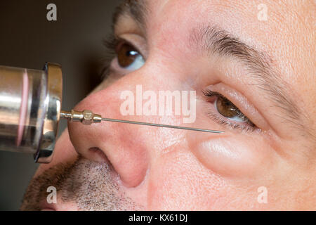 Examination of the sick eye and eyelid in the hospital. Doctor with injection treats the eyes of a man. Treatment of the diseased eye. Experiment with Stock Photo