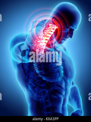 3D illustration, neck painful - cervical spine skeleton x-ray, medical concept. Stock Photo