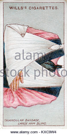 Vintage First Aid illustrations - Trangular bandage, large arm sling Stock Photo