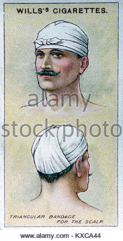 Vintage First Aid illustrations - Triangular bandage for the scalp Stock Photo