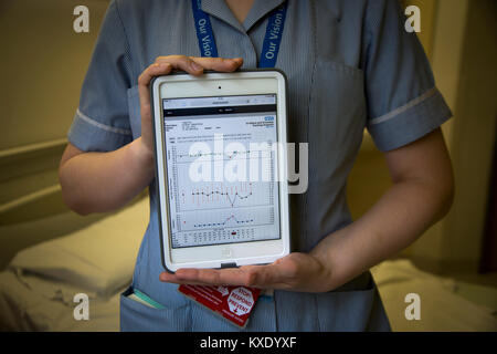 Staff nurse Charlotte Howden, showing displaying data on an iPad on a ward at Whiston Hospital in Merseyside. The device is used to facilitate the Electronic Modified Early Warning System (EMEWS) which helps alert clinical staff to which patients require priority treatment at the hospital. The system, introduced at Whiston Hospital in 2016, allows staff to monitor and regulate patient care in a more efficient way than previous paper-based systems. Stock Photo